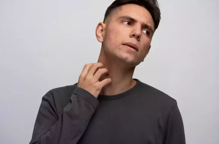 cara atasi leher hitam berdaki  berbagai sumber  cara atasi leher hitam berdaki  berbagai sumber