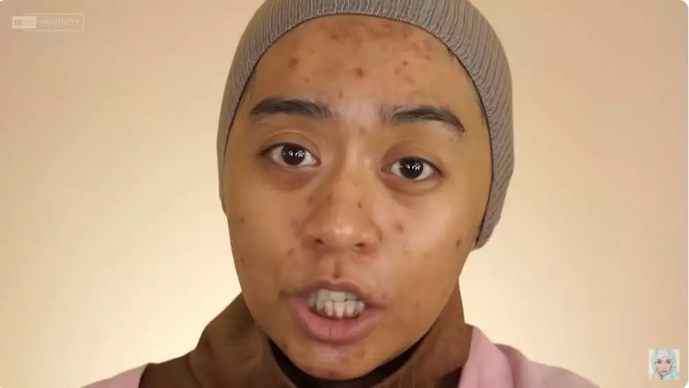 sulap wajah wanita penuh jerawat jadi flawless berbagai sumber