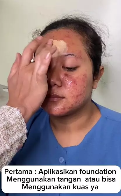 Transformasi makeup wajah berjerawat jadi manten Jawa TikTok Transformasi makeup wajah berjerawat jadi manten Jawa TikTok