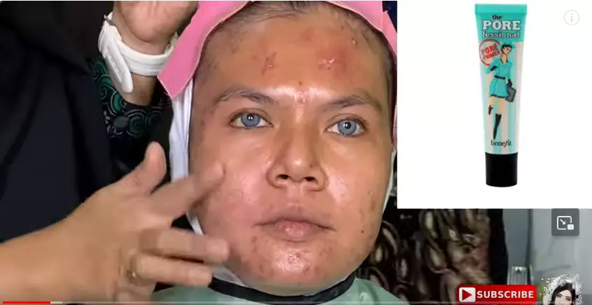 Transformasi makeup pengantin wajah jerawatan dan bopeng berbagai sumber Transformasi makeup pengantin wajah jerawatan dan bopeng berbagai sumber