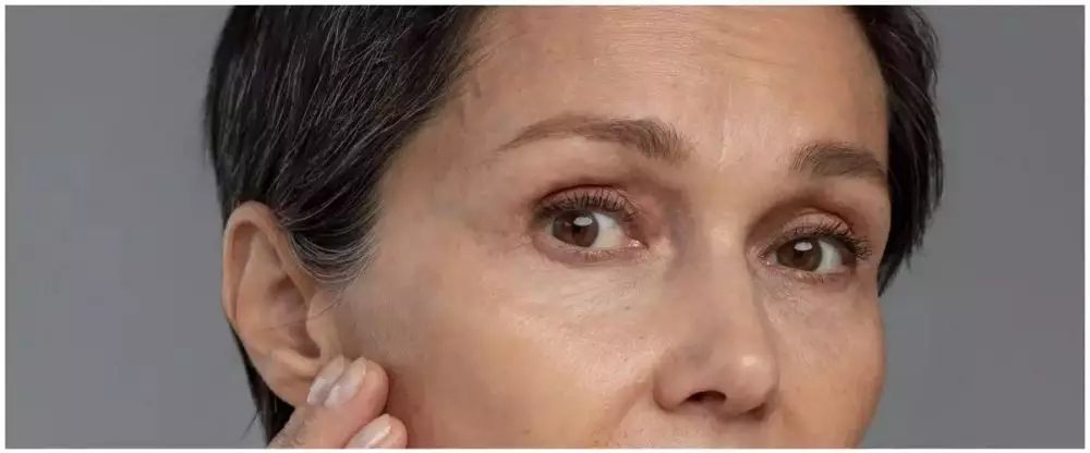 7 cara atasi kerutan di sekitar mata Berbagai sumber 7 cara atasi kerutan di sekitar mata Berbagai sumber