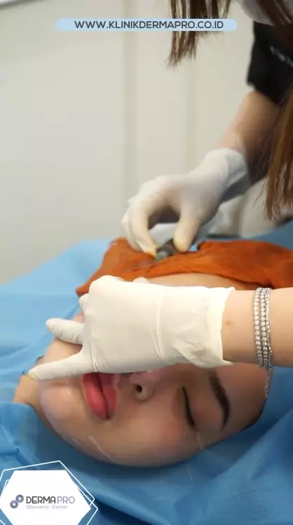 Amanda Manopo jalani tanam benang © Instagram Amanda Manopo jalani tanam benang © Instagram