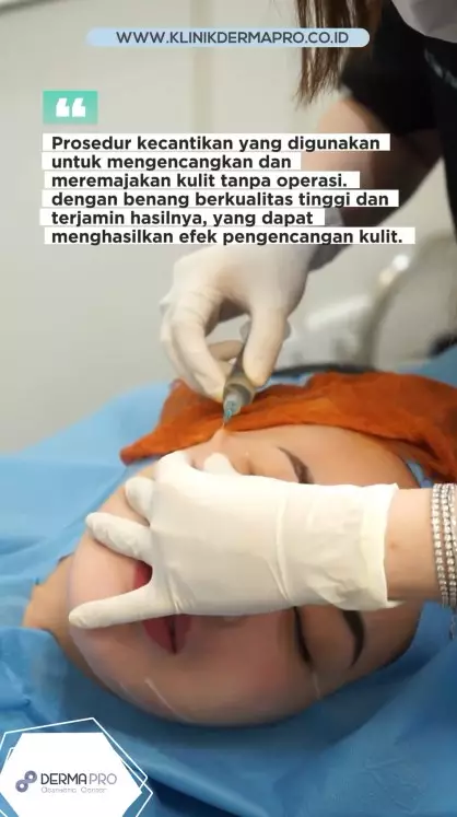 Amanda Manopo jalani tanam benang © Instagram Amanda Manopo jalani tanam benang © Instagram