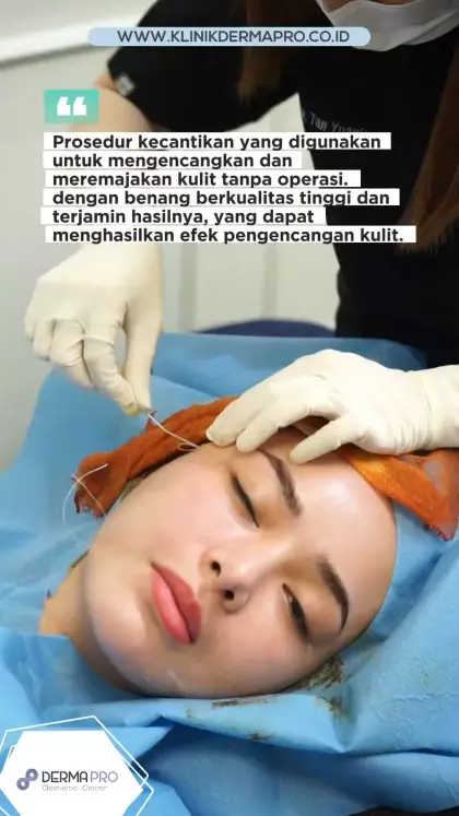 Amanda Manopo jalani tanam benang © Instagram Amanda Manopo jalani tanam benang © Instagram