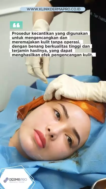 Amanda Manopo jalani tanam benang © Instagram Amanda Manopo jalani tanam benang © Instagram