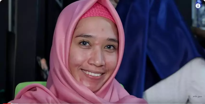 wajah penuh jerawat wisuda berbagai sumber