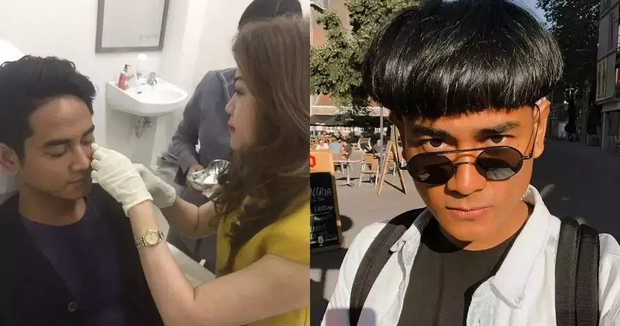 21 Seleb sebelum dan sesudah suntik botoks Berbagai sumber 21 Seleb sebelum dan sesudah suntik botoks Berbagai sumber