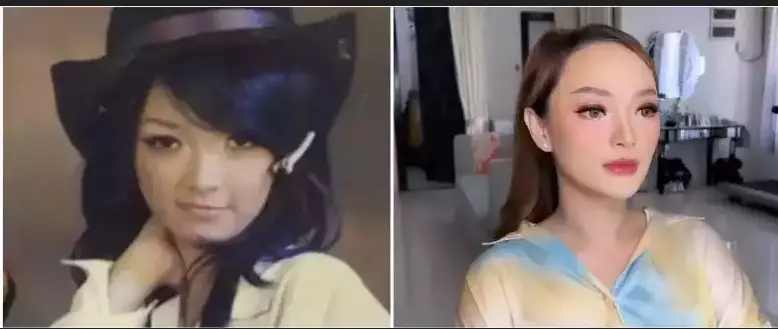 Sebelum dan sesudah tanam benang berbagai sumber Sebelum dan sesudah tanam benang berbagai sumber