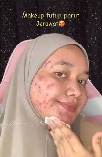 Cewek berjerawat makeup simpel melongo TikTok Cewek berjerawat makeup simpel melongo TikTok