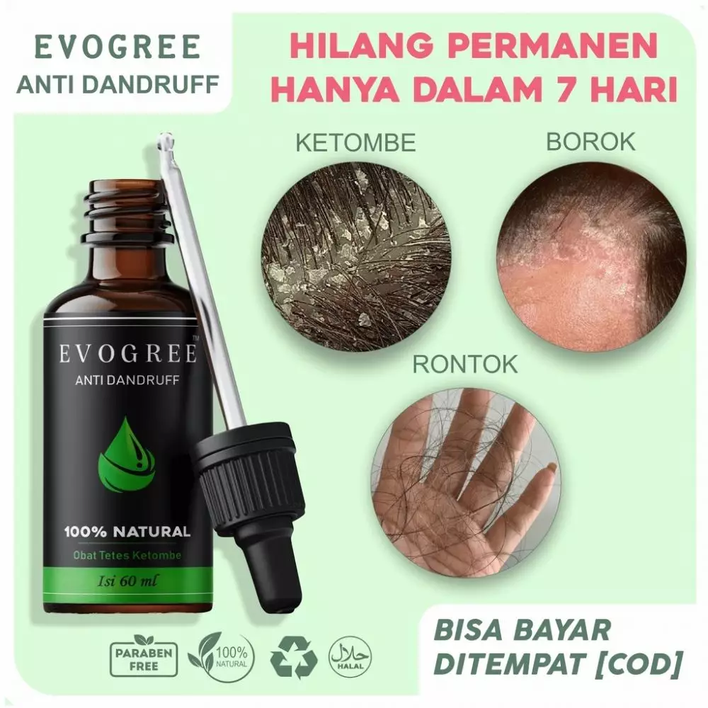Rekomendasi produk untuk rambut berminyak © berbagai sumber