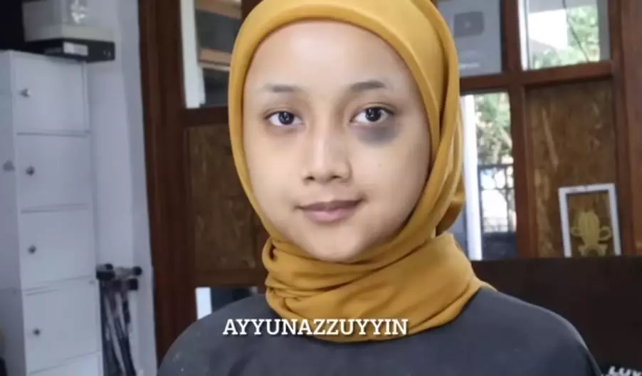 Transformasi makeup dengan tanda lahir di wajah berbagai sumber Transformasi makeup dengan tanda lahir di wajah berbagai sumber