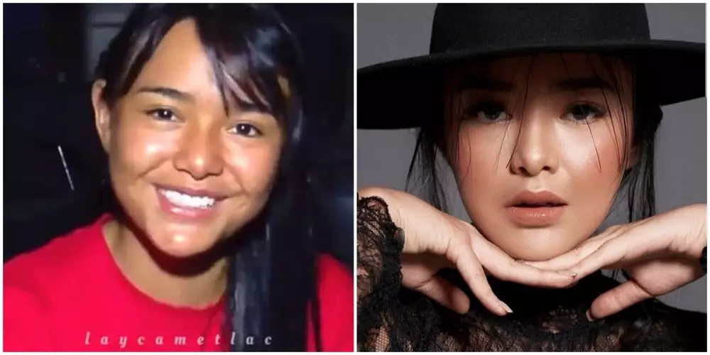 Amanda Manopo sebelum sesudah perawatan © berbagai sumber
