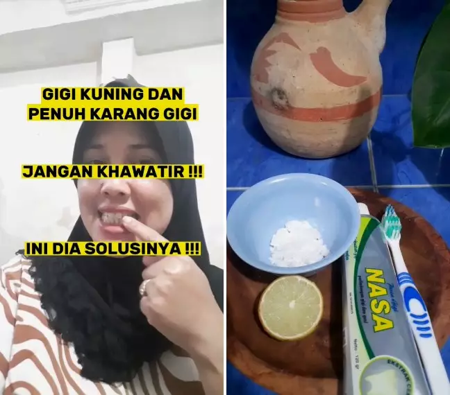 2 Bahan atasi gigi kuning berkarang © 2024 TikTok 2 Bahan atasi gigi kuning berkarang © 2024 TikTok