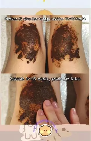 Cerahkan lutut hitam pakai body serum dicampur kopi Berbagai sumber