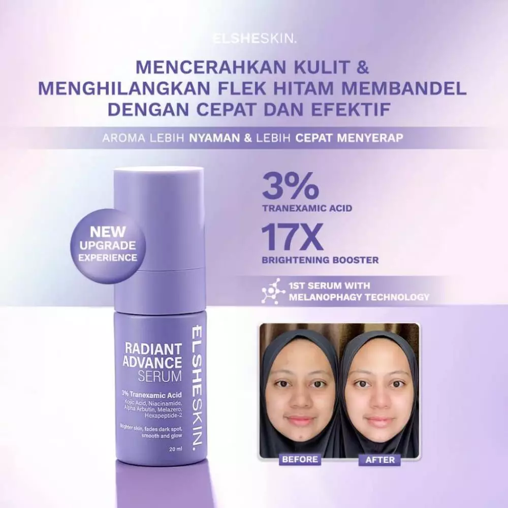 Battle review 5 dark spot serum. berbagai sumber Battle review 5 dark spot serum. berbagai sumber