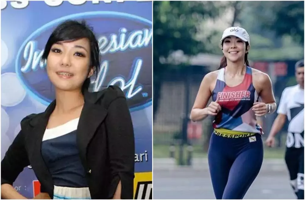 Transformasi penyanyi sebelum dan sesudah pasang behel berbagai sumber