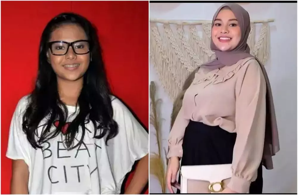 Transformasi penyanyi sebelum dan sesudah pasang behel berbagai sumber