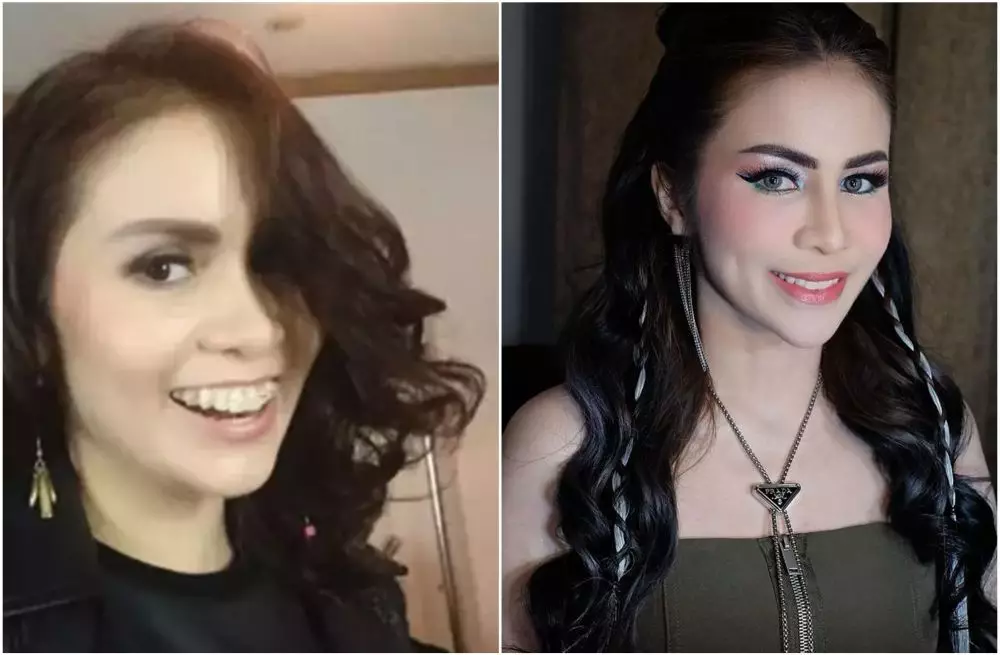 Transformasi penyanyi sebelum dan sesudah pasang behel berbagai sumber