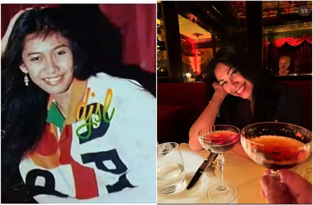 Transformasi penyanyi sebelum dan sesudah pasang behel berbagai sumber