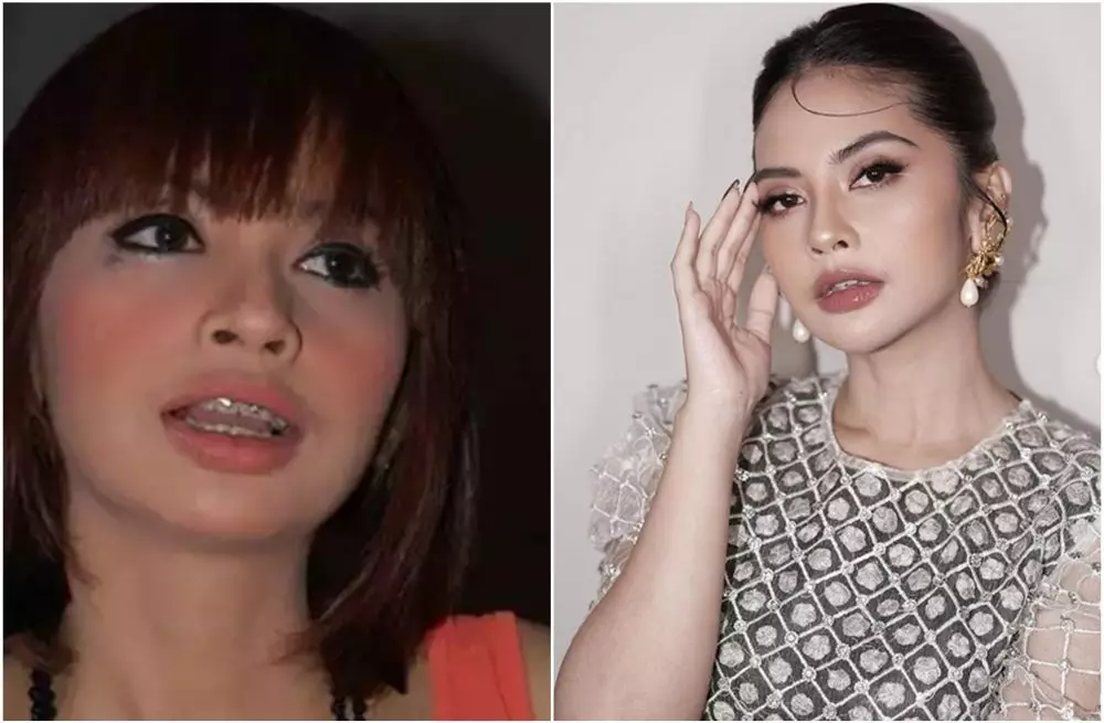 Transformasi penyanyi sebelum dan sesudah pasang behel berbagai sumber