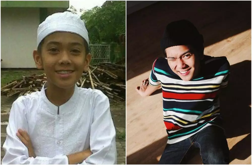 Transformasi penyanyi sebelum dan sesudah pasang behel berbagai sumber