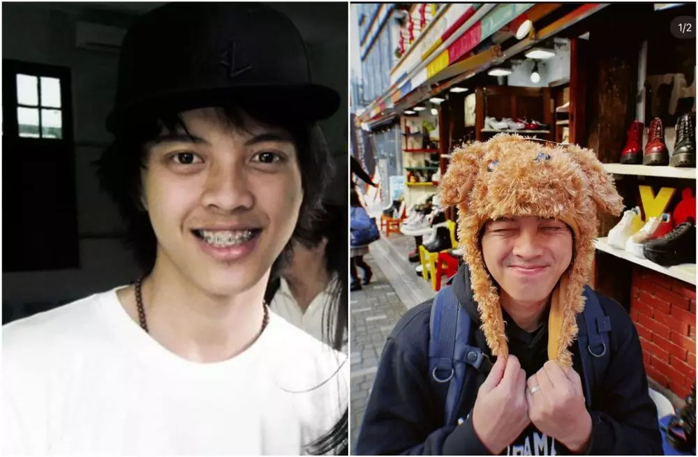 Transformasi penyanyi sebelum dan sesudah pasang behel berbagai sumber