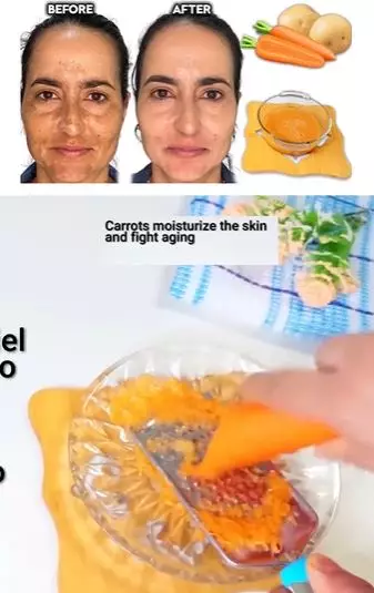 Wortel dan kentang kencangkan wajah keriput Berbagai sumber Wortel dan kentang kencangkan wajah keriput Berbagai sumber