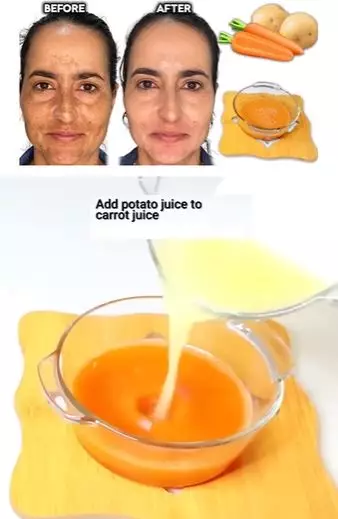 Wortel dan kentang kencangkan wajah keriput Berbagai sumber Wortel dan kentang kencangkan wajah keriput Berbagai sumber