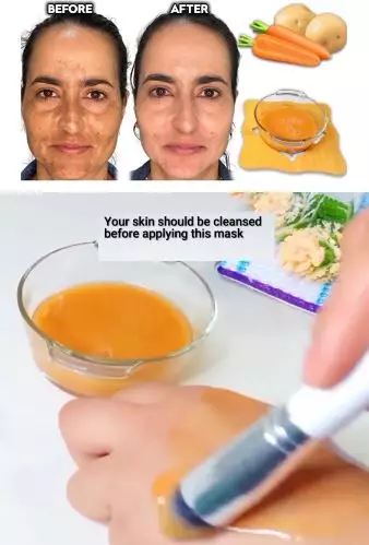 Wortel dan kentang kencangkan wajah keriput Berbagai sumber Wortel dan kentang kencangkan wajah keriput Berbagai sumber