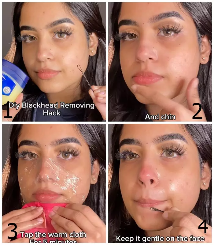 atasi komedo pakai jepit rambut. berbagai sumber