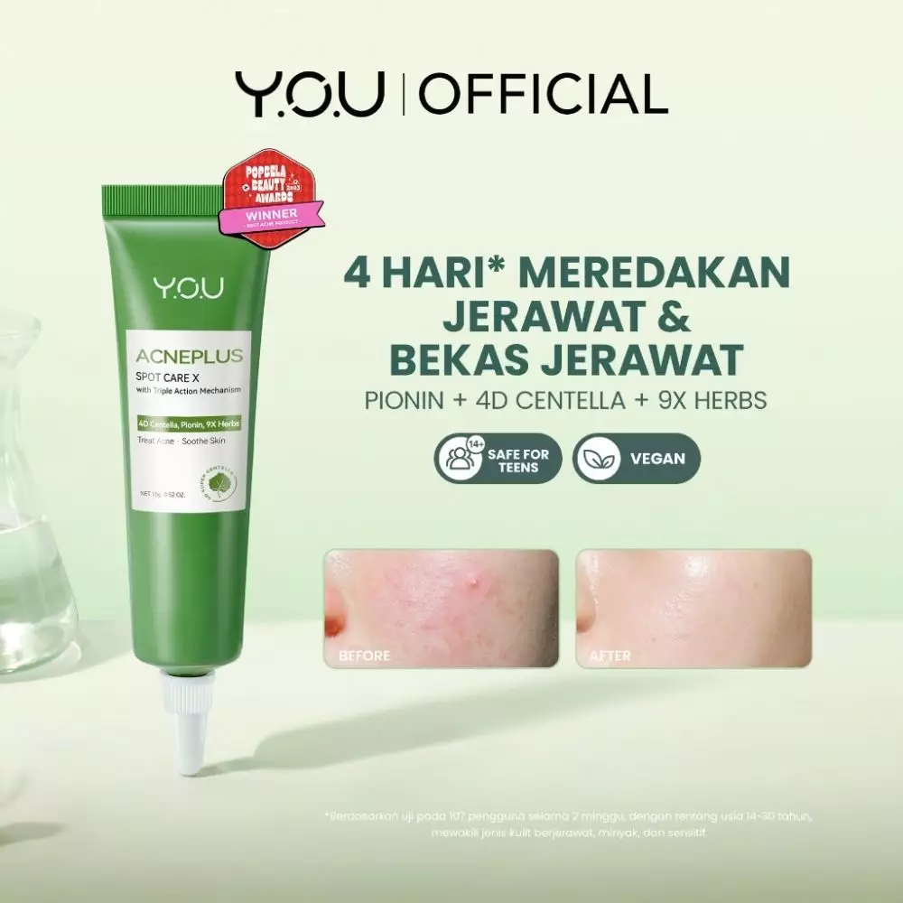Rekomendasi produk YOU acne care © 2024 brilio.net