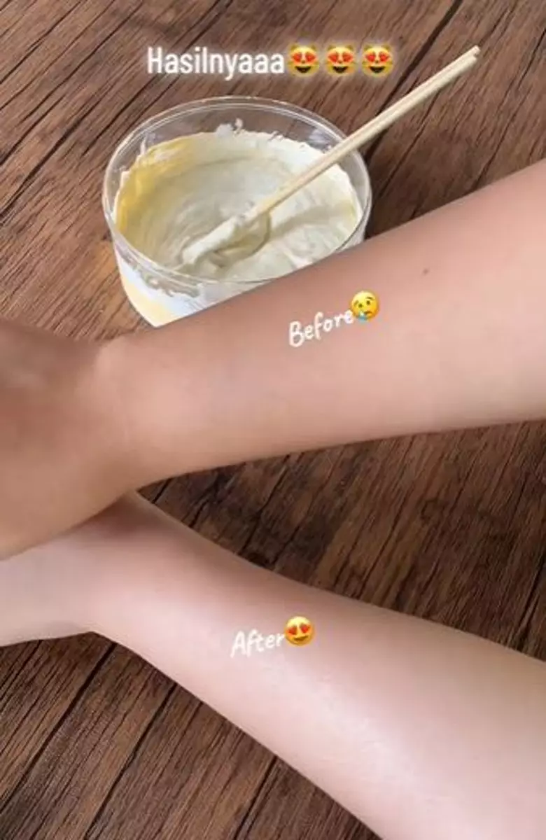 Kulit putih pakai krim jadul dicampur 2 produk skincare Berbagai sumber