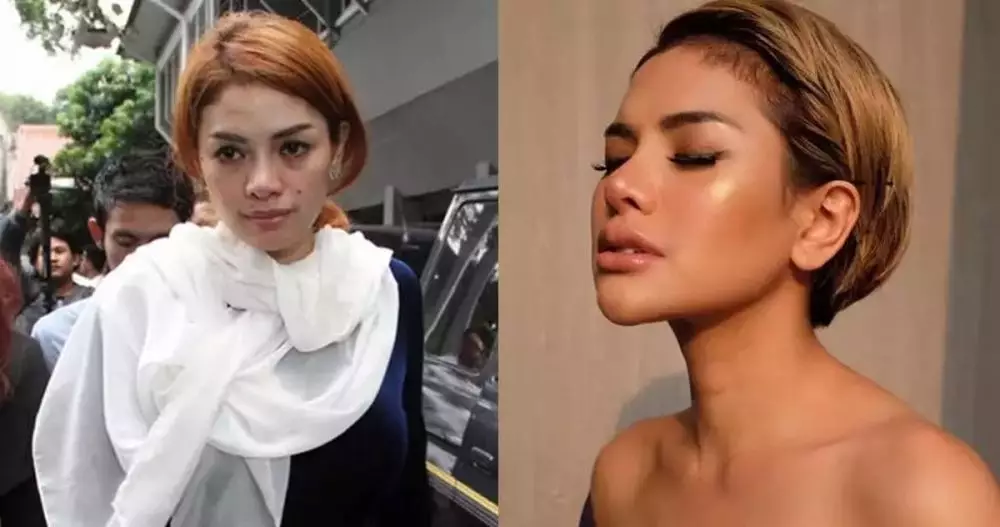 Seleb pilih oplas meski sudah cantik alami Berbagai sumber Seleb pilih oplas meski sudah cantik alami Berbagai sumber