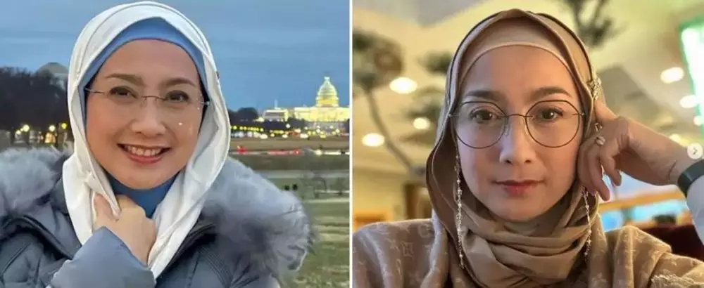 Seleb pilih oplas meski sudah cantik alami Berbagai sumber Seleb pilih oplas meski sudah cantik alami Berbagai sumber