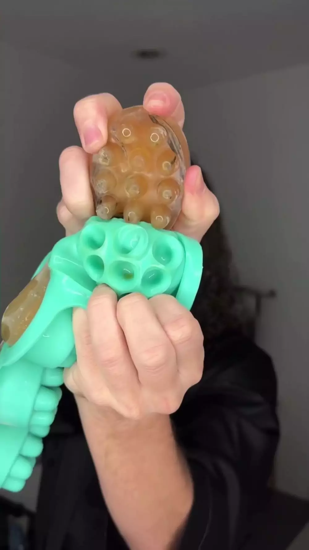 pria ini tunjukan cara atasi kebotakan berbagai sumber