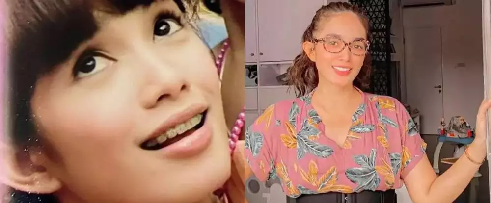 Potret 25 seleb sebelum & sesudah reparasi gigi Berbagai sumber