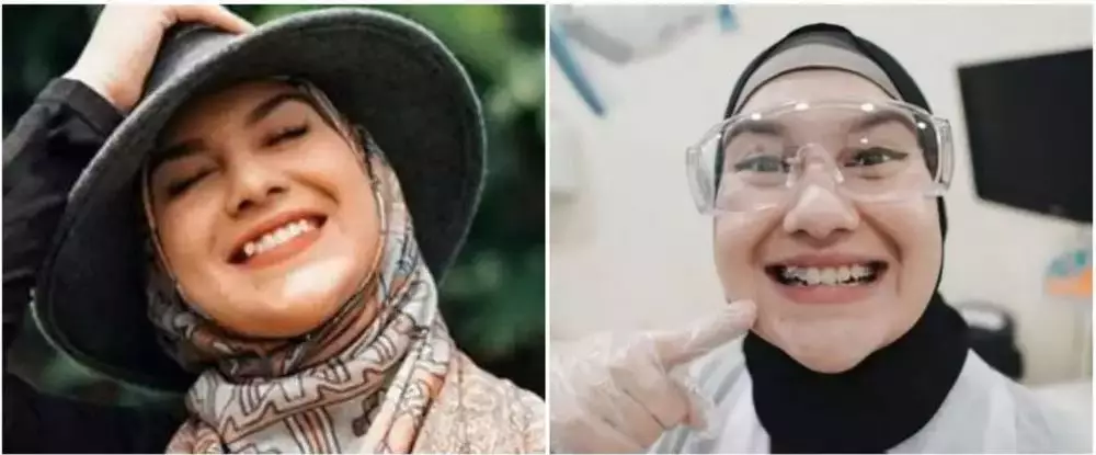 Potret 25 seleb sebelum & sesudah reparasi gigi Berbagai sumber