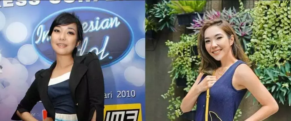 Potret 25 seleb sebelum & sesudah reparasi gigi Berbagai sumber