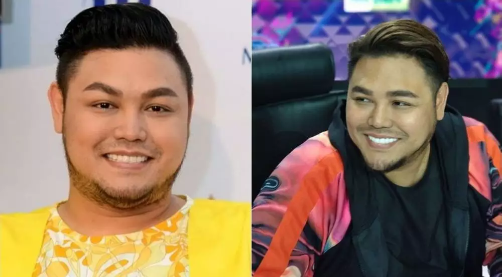 Potret 25 seleb sebelum & sesudah reparasi gigi Berbagai sumber