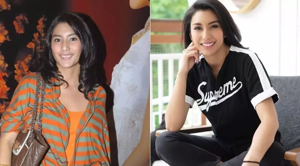 Potret 25 seleb sebelum & sesudah reparasi gigi Berbagai sumber