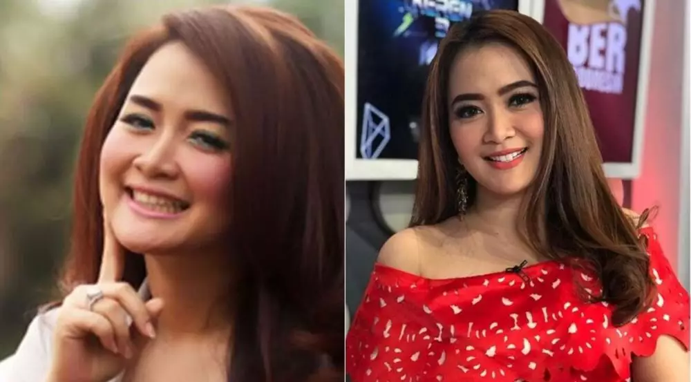 Potret 25 seleb sebelum & sesudah reparasi gigi Berbagai sumber