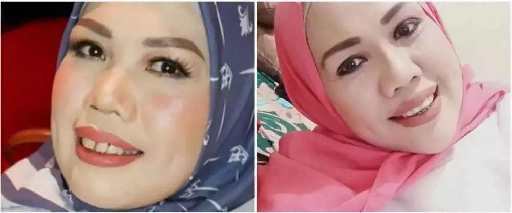 Potret 25 seleb sebelum & sesudah reparasi gigi Berbagai sumber