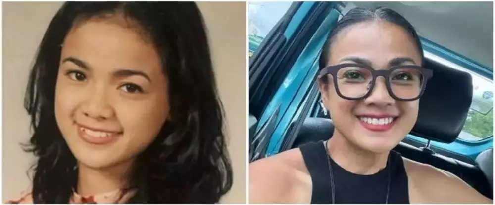 Potret 25 seleb sebelum & sesudah reparasi gigi Berbagai sumber