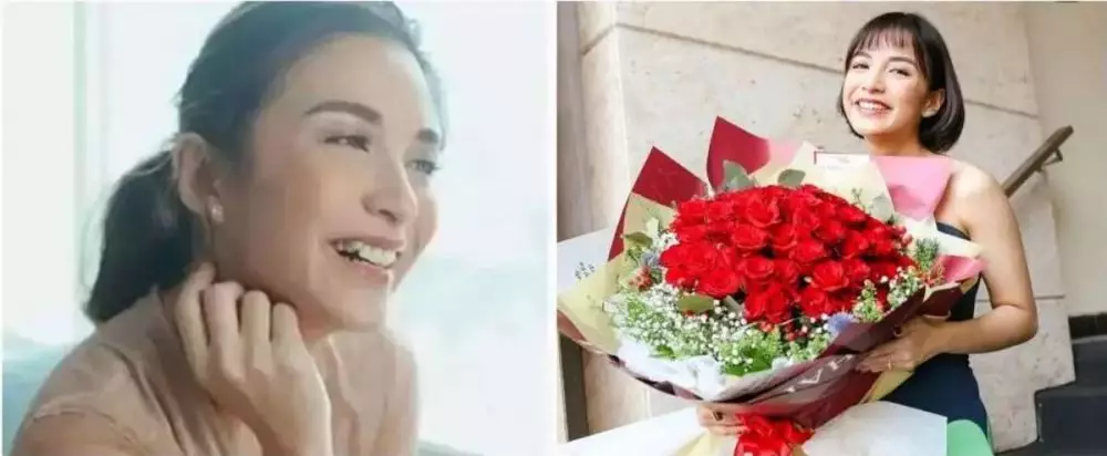 Potret 25 seleb sebelum & sesudah reparasi gigi Berbagai sumber