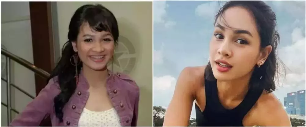 Potret 25 seleb sebelum & sesudah reparasi gigi Berbagai sumber