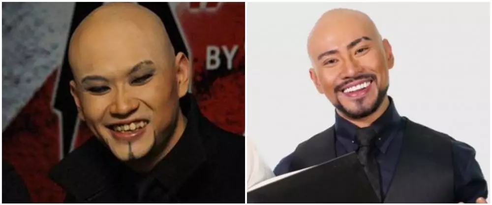 Potret 25 seleb sebelum & sesudah reparasi gigi Berbagai sumber