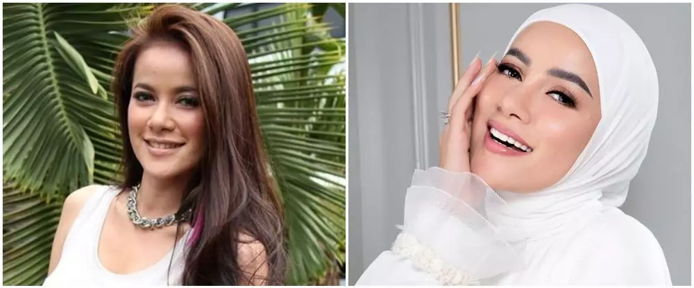 Potret 25 seleb sebelum & sesudah reparasi gigi Berbagai sumber