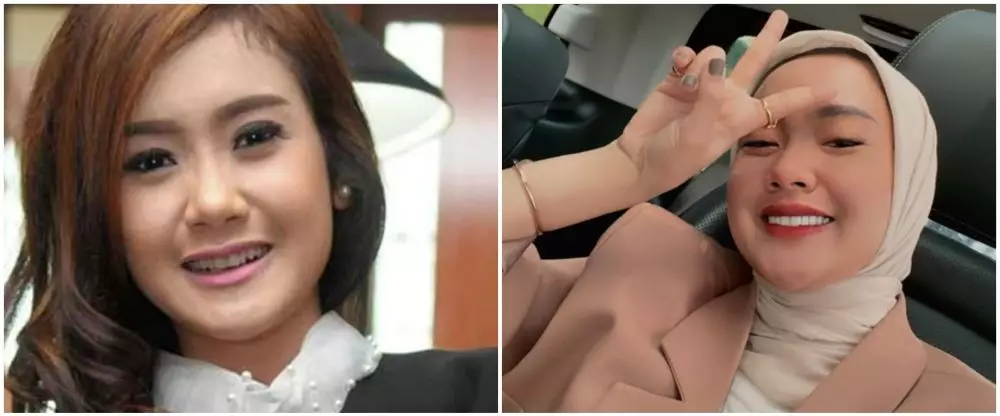 Potret 25 seleb sebelum & sesudah reparasi gigi Berbagai sumber