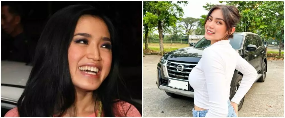 Potret 25 seleb sebelum & sesudah reparasi gigi Berbagai sumber