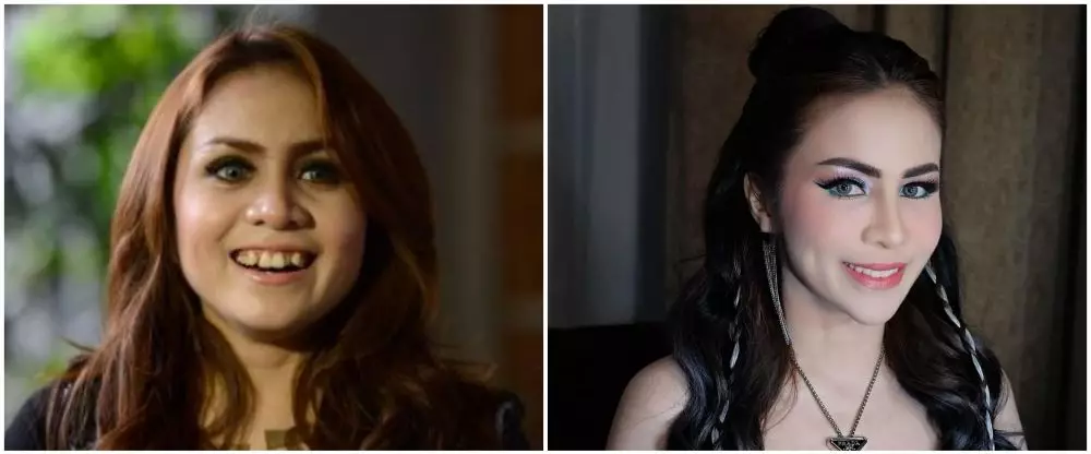 Potret 25 seleb sebelum & sesudah reparasi gigi Berbagai sumber